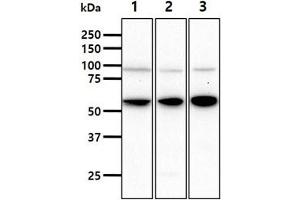 The cell lysates (40ug) were resolved by SDS-PAGE, transferred to PVDF membrane and probed with anti-human HSPA13 antibody (1:1000). (HSPA13 抗体)