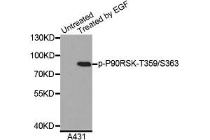 Western blot analysis of extracts of A431 cells, using Phospho-P90RSK-T359/S363 antibody (ABIN5996240). (RPS6KA3 抗体  (pSer363, pThr359))