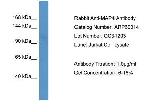 WB Suggested Anti-MAP4  Antibody Titration: 0. (MAP4 抗体  (N-Term))