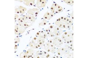 Immunohistochemistry of paraffin-embedded human stomach using RAB3IP antibody at dilution of 1:100 (x40 lens). (RAB3IP 抗体)