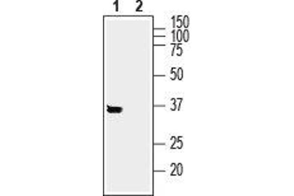 SYNDIG1 抗体  (Intracellular, N-Term)