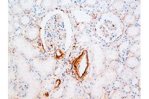 Immunohistochemistry (IHC) image for anti-Vitronectin (VTN) antibody (ABIN108419) (Vitronectin 抗体)