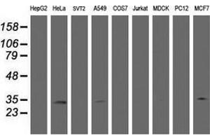 Western Blotting (WB) image for anti-Hydroxysteroid (17-Beta) Dehydrogenase 8 (HSD17B8) (AA 57-261) antibody (ABIN2715556) (HSD17B8 抗体  (AA 57-261))