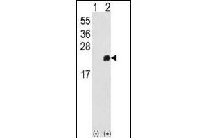Western blot analysis of PRDX1 (arrow) using rabbit polyclonal PRDX1 Antibody (Center) (ABIN389467 and ABIN2839531). (Peroxiredoxin 1 抗体  (AA 88-116))