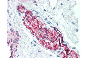 Anti-Nestin antibody IHC of human prostate, nerve. (Nestin 抗体)