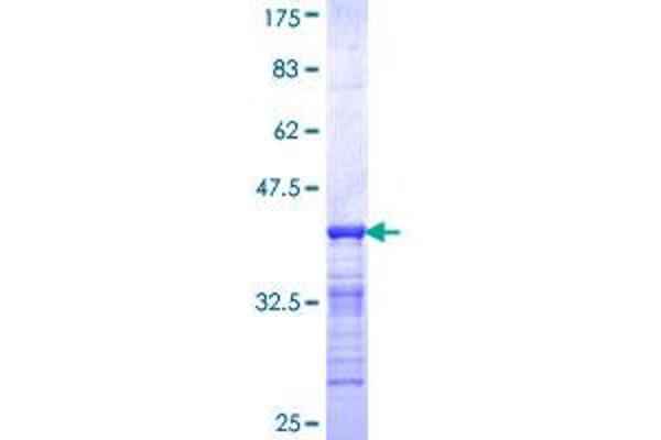 IKZF2 Protein (AA 298-397) (GST tag)