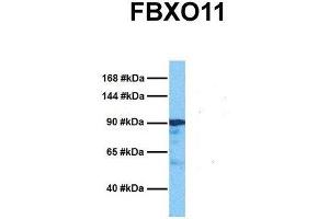 Host:  Rabbit  Target Name:  FBXO11  Sample Tissue:  Human Ovary Tumor  Antibody Dilution:  1. (FBXO11 抗体  (Middle Region))