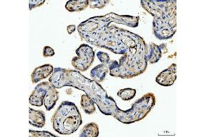 IHC analysis of ANGPTL4 using anti-ANGPTL4 antibody (ABIN5518734). (ANGPTL4 抗体  (C-Term))