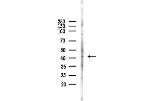 Western blot analysis of lysates from Hela cells(heat-shock,45 min treatment), using HOX Antibody at 1/1000 dilution.
