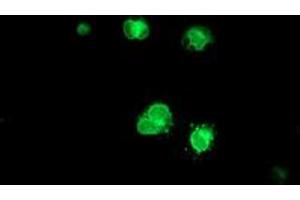 Anti-C6orf64 mouse monoclonal antibody (ABIN2455752) immunofluorescent staining of COS7 cells transiently transfected by pCMV6-ENTRY C6orf64 (RC205273). (SAYSD1 抗体)