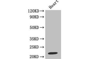 Western blotAll lanes: Metalloproteinase inhibitor 1 antibody at 2 μg/mlLane 1: Jurkat whole cell lysateLane 2: MCF-7 whole cell lysateSecondaryGoat polyclonal to rabbit at 1/10000 dilutionPredicted band size: 23 kDaObserved band size: 23 kDa. (TIMP1 抗体  (AA 24-207))