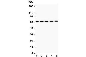 Western blot testing of HNF1A antibody and Lane 1:  rat liver;  2: (r) kidney;  3: (r) RH35;  4: human HeLa;  5: (h) HEPG2. (HNF1A 抗体  (AA 431-631))