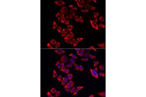 Immunofluorescence analysis of MCF-7 cells using RPL9 antibody. (RPL9 抗体  (AA 1-192))