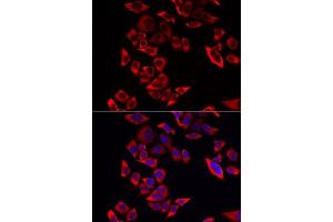 Immunofluorescence analysis of MCF-7 cells using RPL9 antibody. (RPL9 抗体  (AA 1-192))
