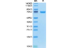 alpha Fetoprotein Protein (AA 19-605) (His tag)