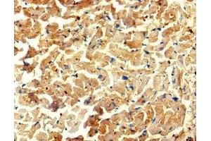Immunohistochemistry of paraffin-embedded human heart tissue using ABIN7175734 at dilution of 1:100 (WDR27 抗体  (AA 501-730))