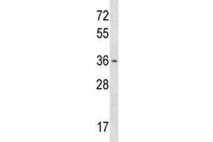 OTX1 antibody western blot analysis in T47D lysate. (OTX1 抗体  (AA 87-116))