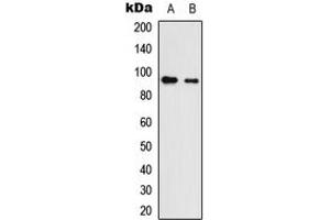 Western blot analysis of Neuroligin 3 expression in HEK293T (A), NS-1 (B) whole cell lysates. (Neuroligin 3 抗体  (C-Term))