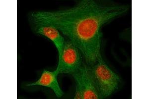 IF analysis of RIMKLB and Tubulin beta using anti-RIMKLB antibody (ABIN7600908) and anti-Tubulin beta antibody (ABIN7602744). (RIMKLB 抗体  (AA 25-386))
