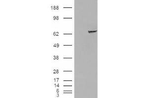 Western Blotting (WB) image for anti-Insulin-Like Growth Factor 2 mRNA Binding Protein 2 (IGF2BP2) (C-Term) antibody (ABIN2466526) (IGF2BP2 抗体  (C-Term))