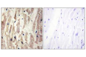 Immunohistochemistry analysis of paraffin-embedded human heart tissue using LAMA4 antibody. (LAMa4 抗体  (Internal Region))