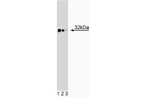 Western blot analysis of TREX1 on a BC3H1 cell lysate (Mouse brain smooth muscle-like cells, ATCC CRL-1443). (TREX1 抗体  (AA 82-179))