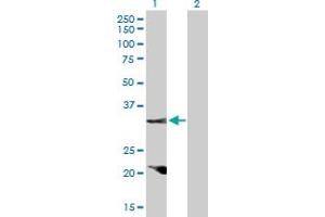 Western Blot analysis of CCND2 expression in transfected 293T cell line by CCND2 MaxPab polyclonal antibody. (Cyclin D2 抗体  (AA 1-289))