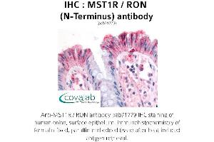 Image no. 1 for anti-Macrophage Stimulating 1 Receptor (C-Met-Related tyrosine Kinase) (MST1R) (N-Term) antibody (ABIN1737098) (MST1R 抗体  (N-Term))