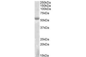 Image no. 1 for anti-Eyes Absent Homolog 1 (EYA1) (Internal Region) antibody (ABIN487975) (EYA1 抗体  (Internal Region))