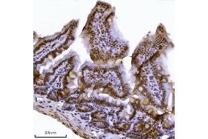 IHC analysis of JHDM3A/JMJD2A/KDM4A using anti-JHDM3A/JMJD2A/KDM4A antibody (ABIN7601534).