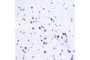 Immunohistochemistry (IHC) image for anti-Histone 3 (H3) (H3K36me3) antibody (ABIN3016039)