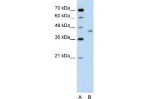 Western Blotting (WB) image for anti-LRP2 Binding Protein (LRP2BP) antibody (ABIN2462598) (LRP2BP 抗体)