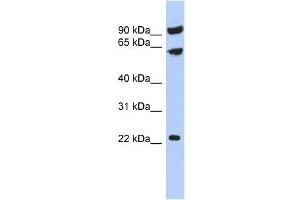 TIGD3 antibody used at 1 ug/ml to detect target protein. (TIGD3 抗体  (Middle Region))