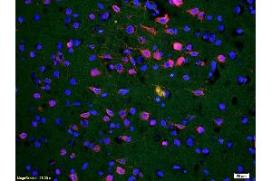Formalin-fixed and paraffin-embedded rat brain labeled with Anti-ROR1/ROR alpha Polyclonal Antibody, Unconjugated (ABIN1387717) 1:200, overnight at 4°C, The secondary antibody was Goat Anti-Rabbit IgG, Cy3 conjugated used at 1:200 dilution for 40 minutes at 37°C.