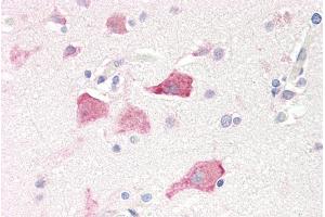 ABIN185519 (5µg/ml) staining of paraffin embedded Human Cortex. (RPS19 抗体  (Internal Region))