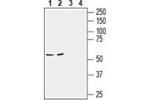 Western blot analysis of mouse brain (lanes 1 and 3) and colon (lanes 2 and 4) lysates: - 1,2. (Slc6a14 抗体  (2nd Extracellular Loop))
