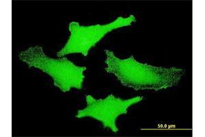 Immunofluorescence of monoclonal antibody to PIM1 on HeLa cell. (PIM1 抗体  (AA 1-313))