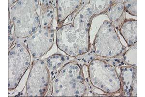 Immunohistochemical staining of paraffin-embedded Human Kidney tissue using anti-LDLRAP1 mouse monoclonal antibody. (LDLRAP1 抗体)