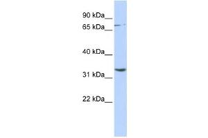 Western Blotting (WB) image for anti-Dpy-19-Like 1 (C. Elegans) (DPY19L1) antibody (ABIN2458759)