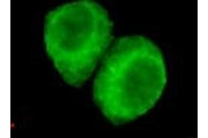 Immunocytochemistry of HeLa cells using anti-JMJD6(N-terminus) mouse mAb diluted 1:200. (JMJD6 抗体  (N-Term))