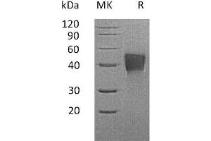 Western Blotting (WB) image for Tumor-Associated Calcium Signal Transducer 2 (TACSTD2) protein (His tag) (ABIN7320759)