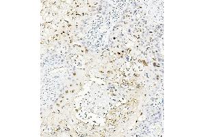 IHC analysis of MAFA using anti-MAFA antibody (ABIN7602623). (MAFA 抗体  (AA 9-308))