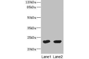 Western Blot All lanes: UBE2T antibody at 10 μg/mL Lane 1: HepG2 whole cell lysate Lane 2: Hela whole cell lysate Secondary Goat polyclonal to rabbit IgG at 1/10000 dilution Predicted band size: 23 kDa Observed band size: 23 kDa (Ube2t 抗体  (AA 1-197))