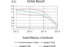 Black line: Control Antigen (100 ng),Purple line: Antigen (10 ng), Blue line: Antigen (50 ng), Red line:Antigen (100 ng) (CYLD 抗体  (AA 204-358))
