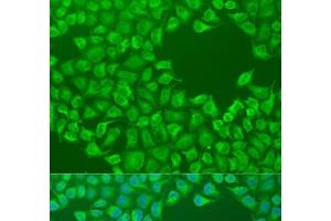 Immunofluorescence analysis of U2OS cells using CEP57L1 Polyclonal Antibody at dilution of 1:100. (CEP57L1 抗体)
