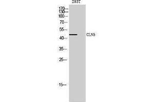 Western Blotting (WB) image for anti-Ceroid-Lipofuscinosis, Neuronal 5 (CLN5) (Internal Region) antibody (ABIN3183965) (CLN5 抗体  (Internal Region))