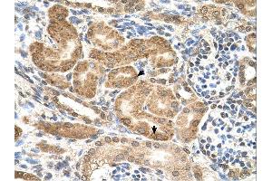 GMPPB antibody was used for immunohistochemistry at a concentration of 4-8 ug/ml.