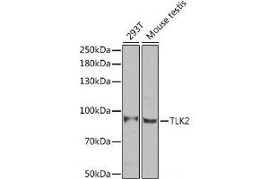 Western blot analysis of extracts of various cell lines using TLK2 Polyclonal Antibody at dilution of 1:1000. (TLK2 抗体)