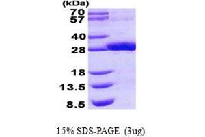 Epidermal Retinal Dehydrogenase 2 (RDHE2) protein (His tag)