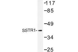 Image no. 1 for anti-Somatostatin Receptor 1 (SSTR1) antibody (ABIN317866) (SSTR1 抗体)